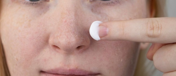 Tratamientos faciales en Lleida para pieles secas